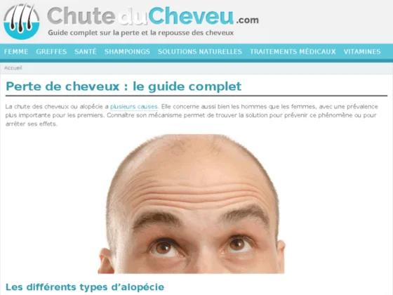 Le guide pratique contre la calvitie