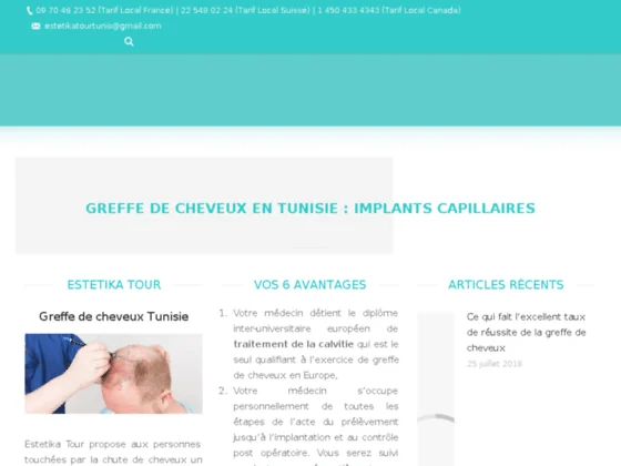 implant capillaire tunisie