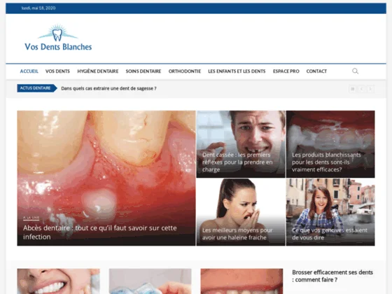 Tout savoir sur l'abcès dentaire