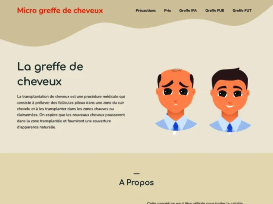Informations sur la greffe de cheveux
